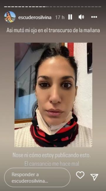 Silvina Escudero contó un problema de salud que atraviesa y preocupó a sus seguidores Revista Que